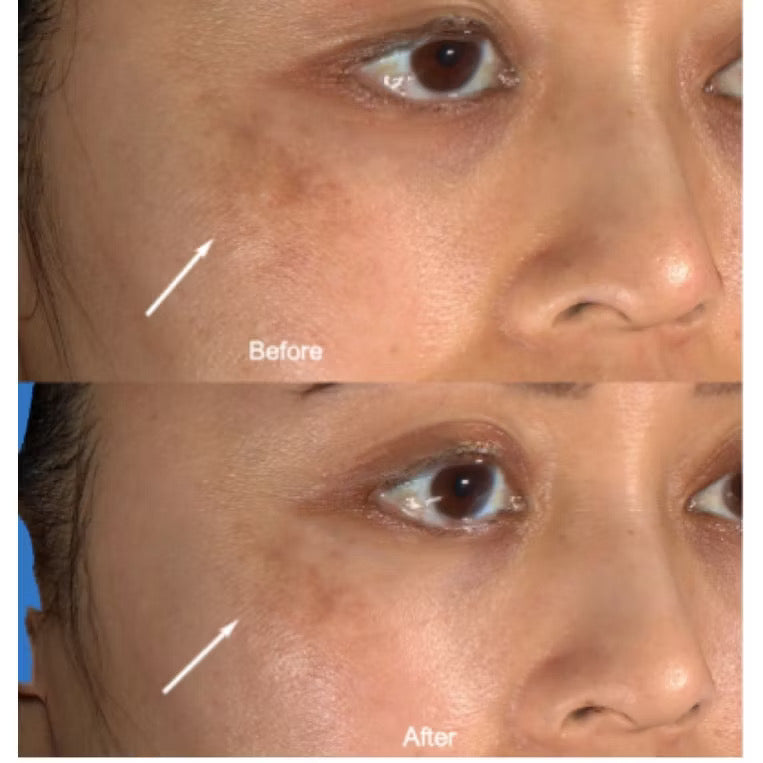 Skinuva Brite