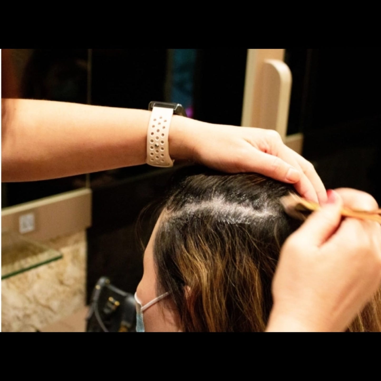 Scalp Treatment 1