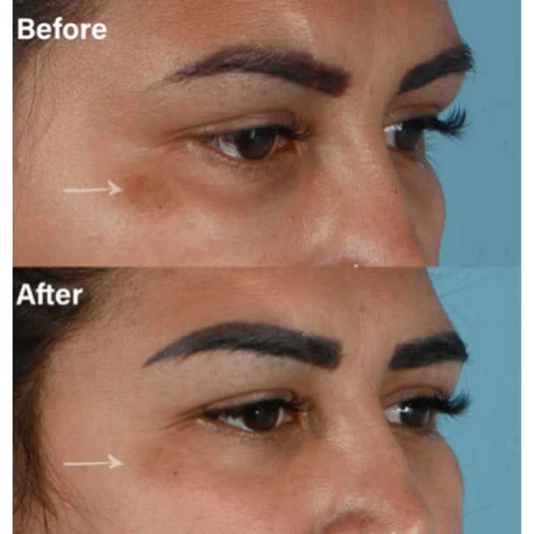 Skinuva Brite