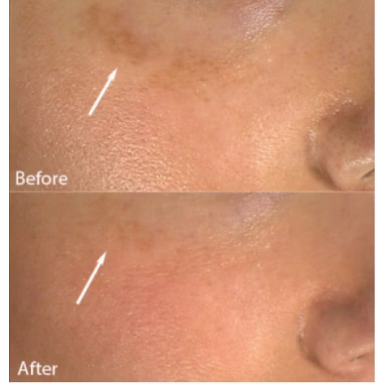 Skinuva Brite
